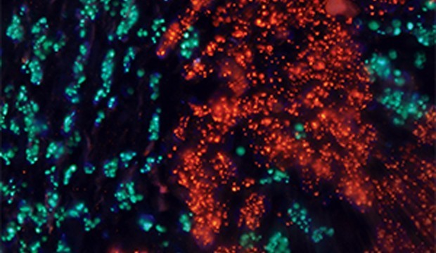human_cancer_cells_1_washington_uni.jpg