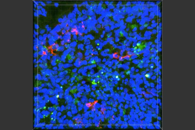 MIT-Alzheimers-Protein.jpg