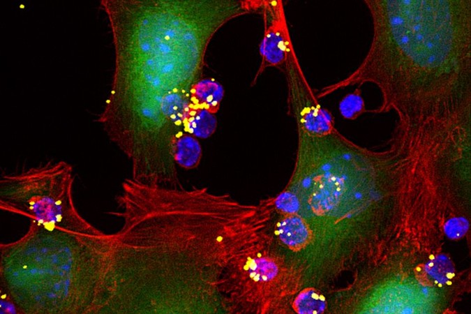 MIT-T-Cell-Therapy.jpg