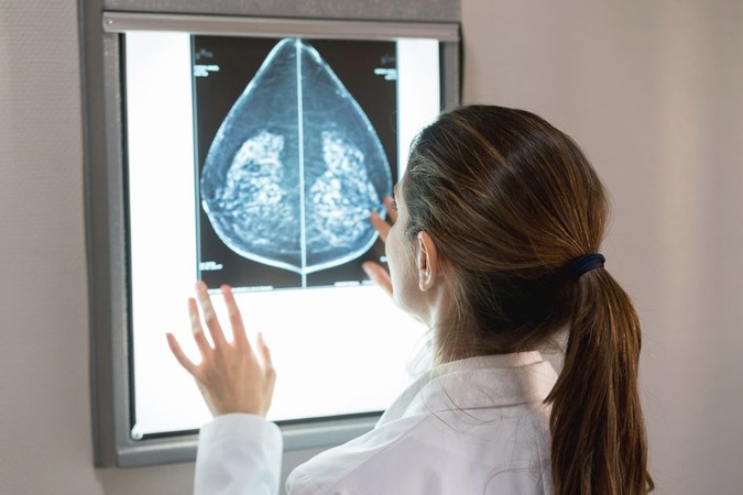MIT-Mammogram-AI-01.jpg