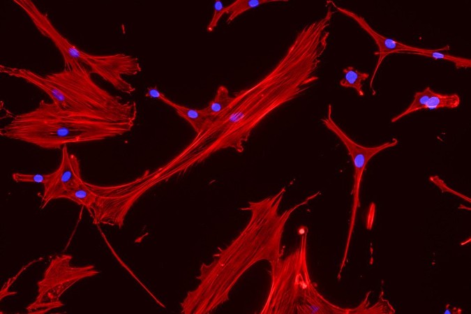MIT-Stem-Cell-Mechanics.jpg