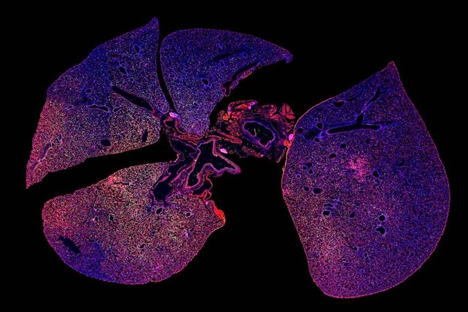 MIT-Detecting-Infection.jpg