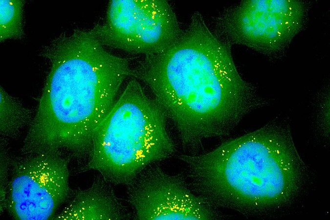 MIT-Inhalable-RNA.jpg