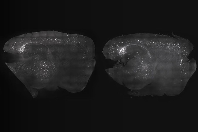 MIT-Alzheimers-Gamma.jpg