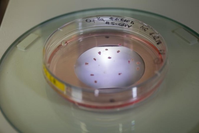 brain_organoids.jpg