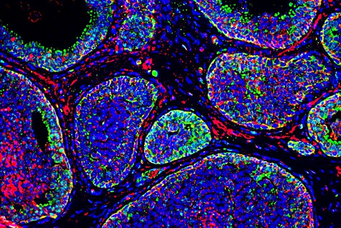 MIT-Tumor-Acidity.jpg