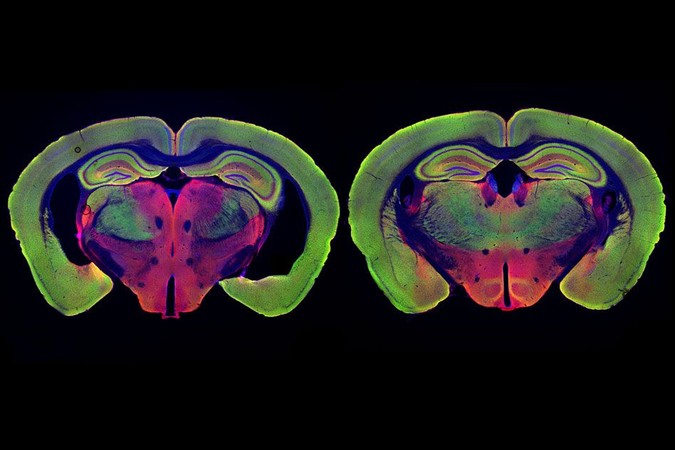 MIT-Alzheimers-Treatment_1.jpg