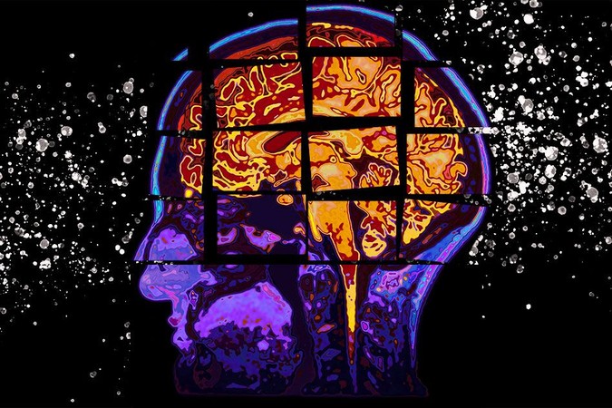 MIT-Alzheimers-Forecasting-01.jpg