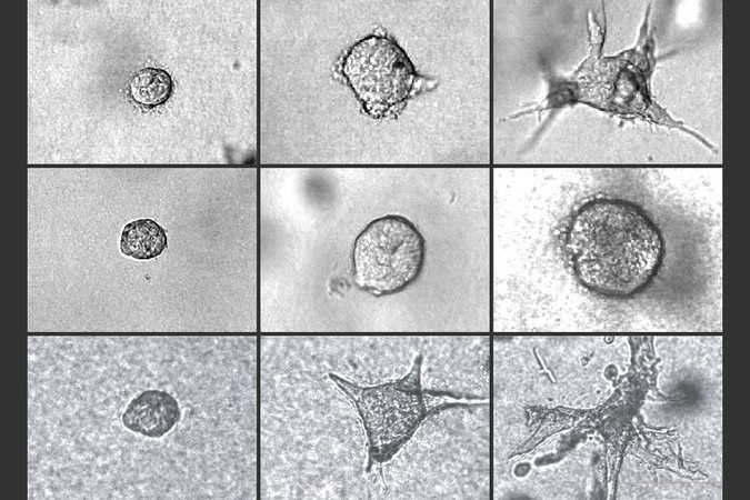 MIT-Tumor-Invasion.jpg