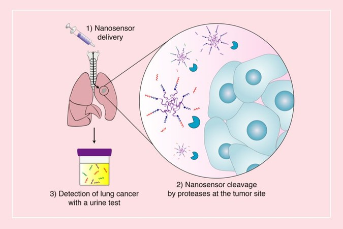 MIT-Early-Detection-01.jpg