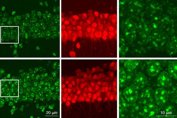 MIT-Aging-Neurons.jpg