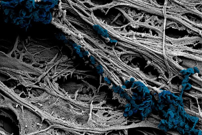 MIT-Magnetic-Nanodiscs-01.jpg