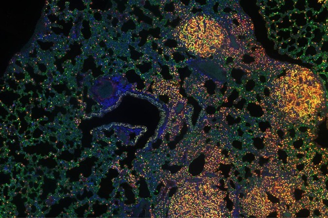 MIT-Cancer-Epigenome-01.jpg