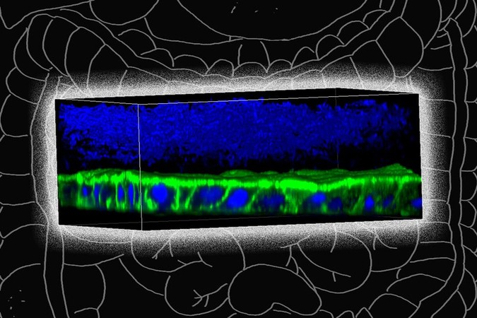 MIT-Microbiome-Model-01.jpg