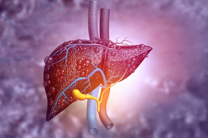 MIT-Liver-Diagnosis-01.jpg