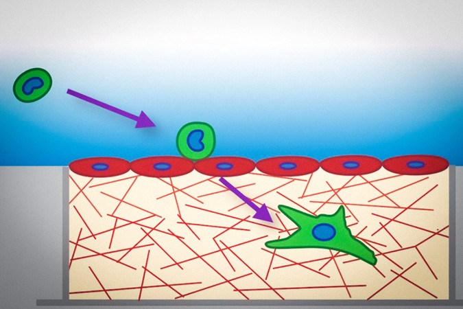 MIT-soft-tumor-cells-01-press.jpg