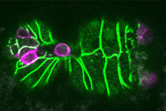 MIT-Cell-Elimination-01-press.jpg