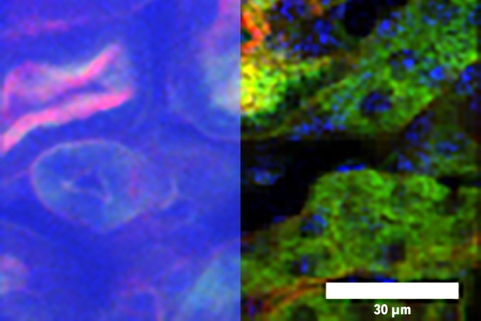MIT-Fast-Brain-Imaging-01-press.jpg