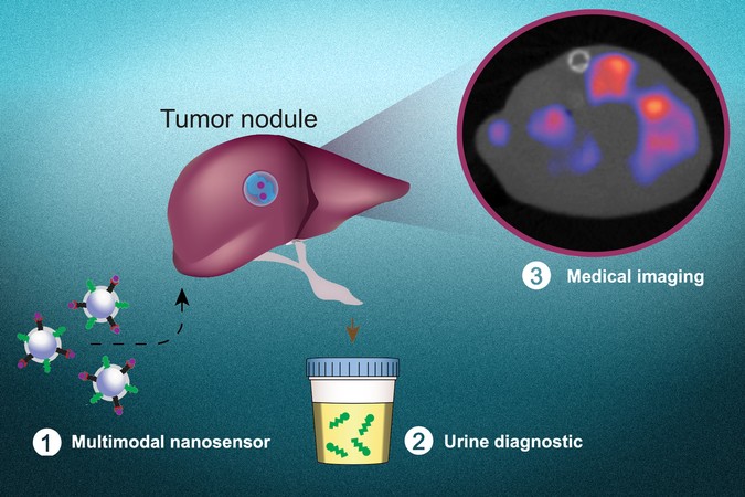 MIT-Cancer-Diagnostic-01-press.jpg