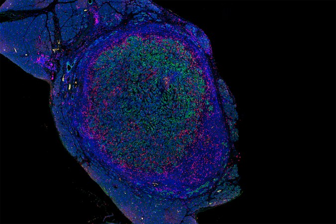 MIT_Pancreatic-Cancer-01-PRESS.jpg