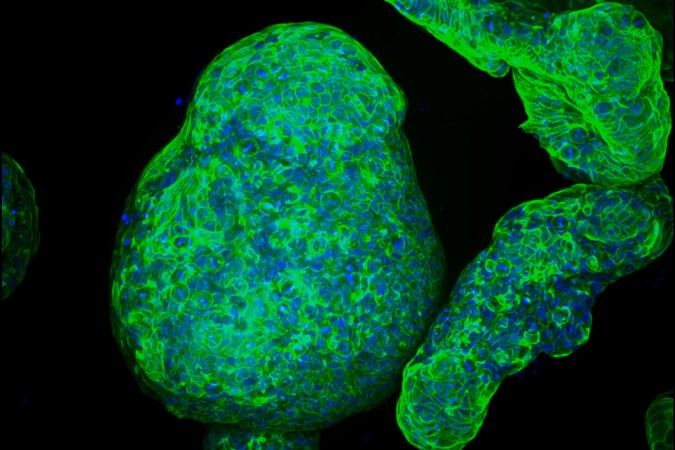 MIT-Pancreatic-Tumor-01-press.jpg