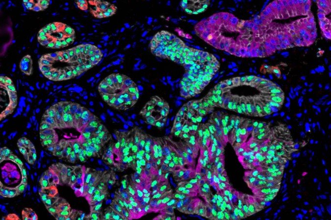 MIT-Cancer-States-01-press.jpg