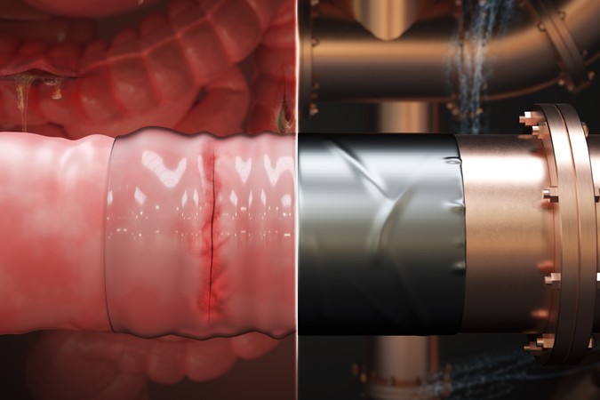 MIT-Surgical-Duct-Tape01-PRESS.jpg