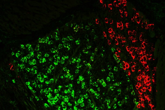 MIT-Aging-Thalmus-01-PRESS.jpg