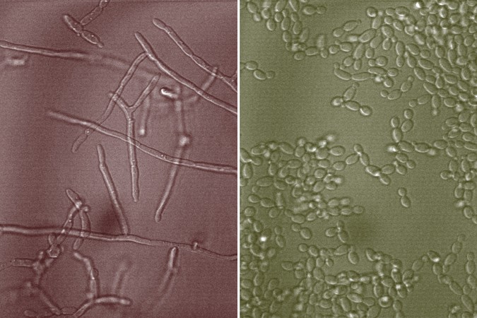 MIT-Mucins-Fungus-01-press.jpg