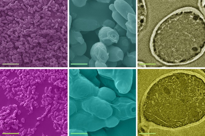 MIT-Lead-Yeast-01-press.jpg