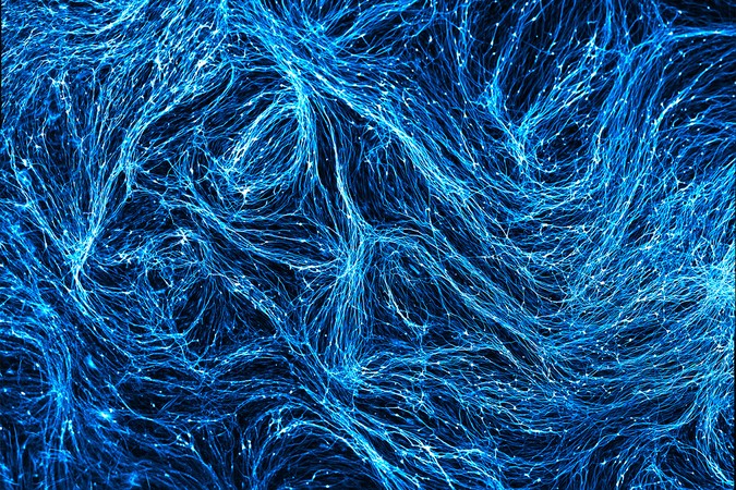 MIT-alzheimers-microglia-01-press.jpg