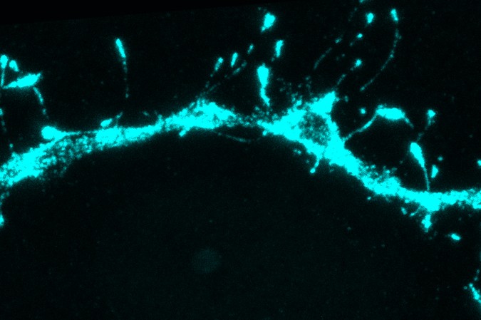 MIT-Silent-Synapses-01-PRESS.jpg