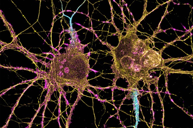 MIT-Huntingtons-Cells-01-press.jpg