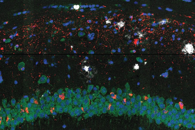MIT-AlzheimersMap-01-press.jpg