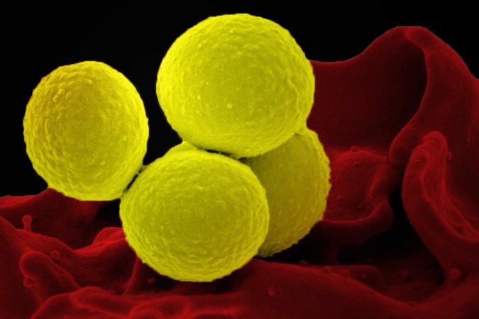MIT-Skin-Microbiome-01-PRESS.jpg