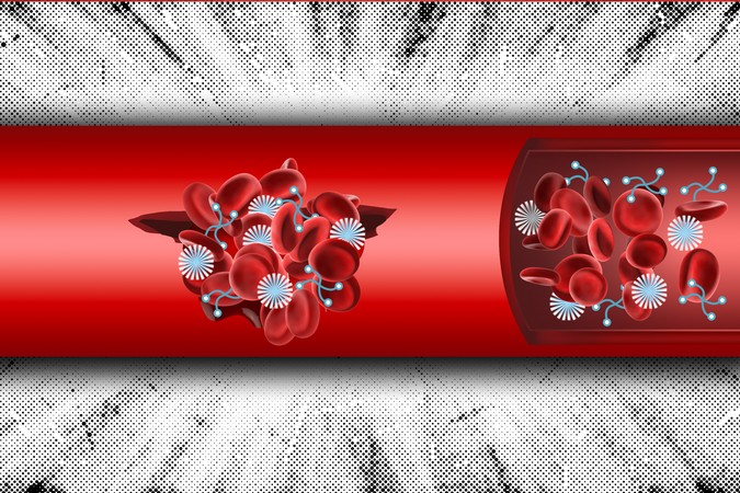 MIT_Blood-Clotting-01-PRESS.jpg