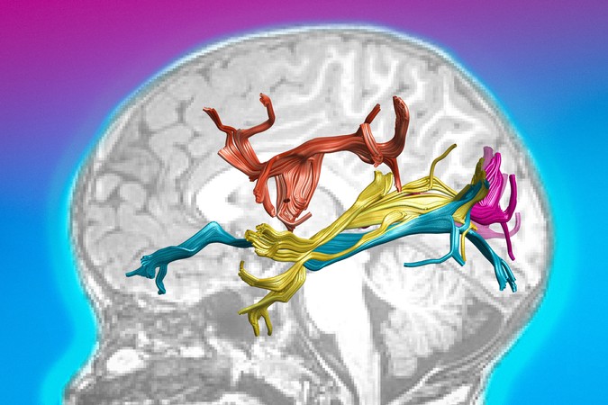MIT-BrainPlasticity-01-press.jpg