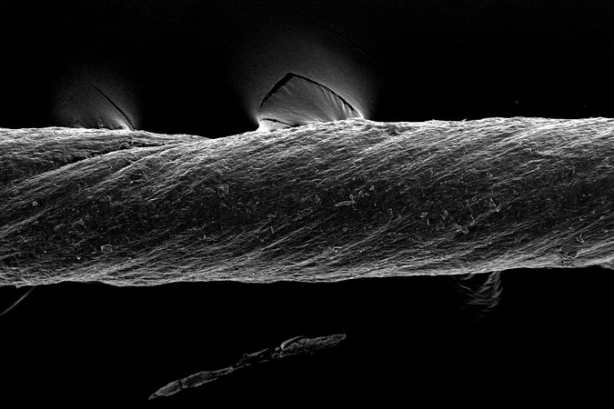 MIT-SmartSutures-01-press.jpg