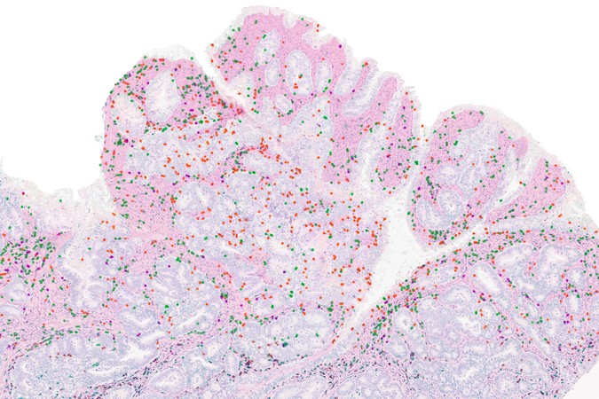 MIT-Tumor-Mutations-01-press.jpg