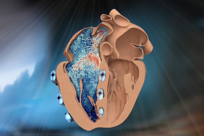 MIT-Right-Heart-01-PRESS.jpg