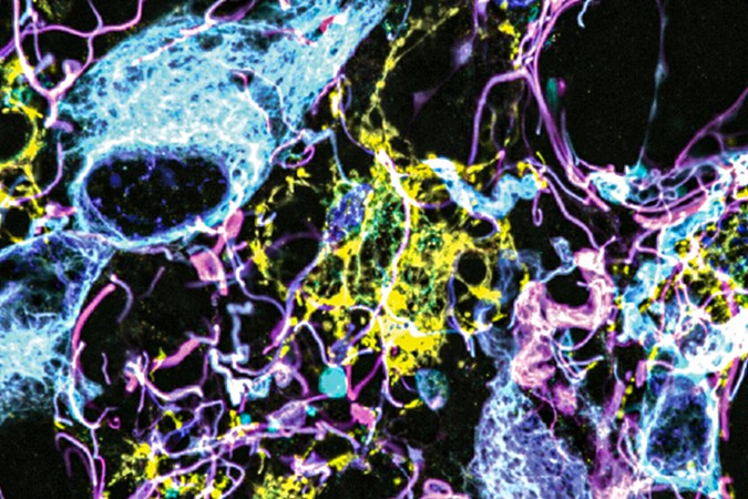 MIT-Visualising-Tumors-01-press.jpg