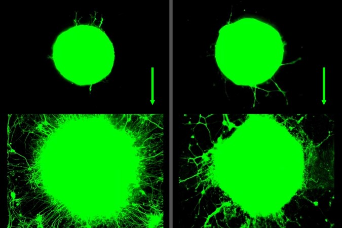 MIT-Exercising-neurons-01-press.jpg