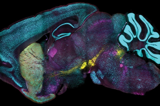 mouse-brain-proteins.jpg