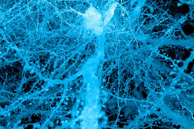 mit-expansion-microscopy.jpg