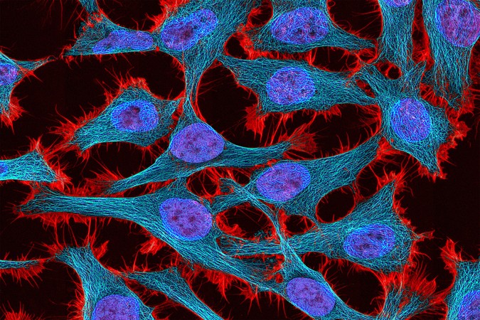 MIT-Gene-Therapy-01-press.jpg