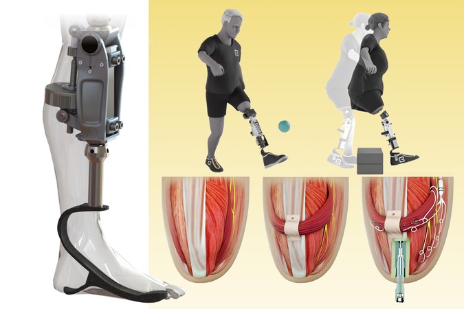 MIT_Bionic-Knee-01-press.jpg