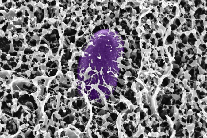 MIT_glycans-salmonella-01-press.jpg