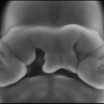 mouse-embryo-1.jpg