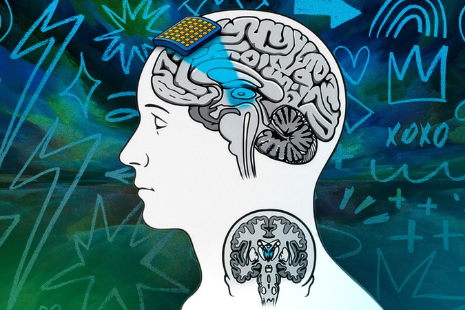 MIT-Transcranial-Ultra-01-press.jpg
