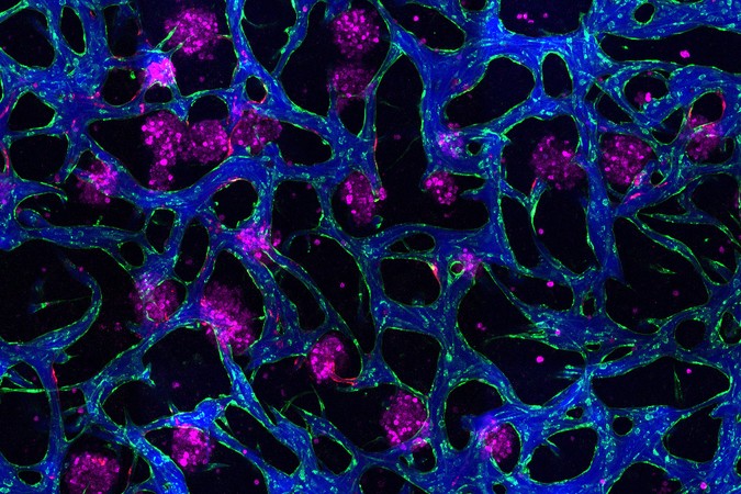 MIT-liver-model-01-press.jpg